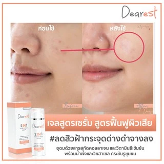 Dearest 2in1 mask&clean เจลล้างหน้าสูตรเซรั่ม เดียร์เรส 100 ml