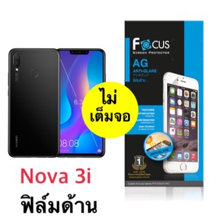 ฟิล์มด้าน nova 3i ยี่ห้อโฟกัส