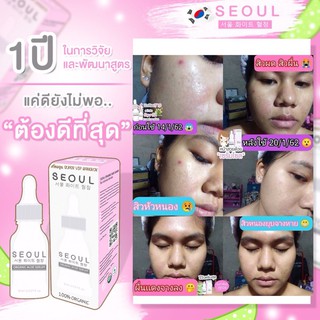 Seoul Serum เซรั่มโซลอโล ขนาด 8 ml.(หน้ากล่องสีชมพู)