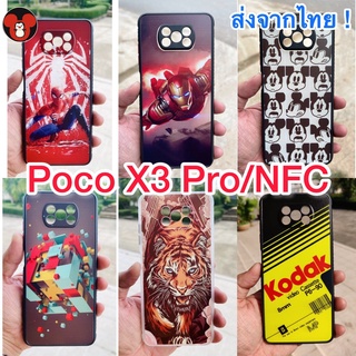 เคส Poco X3 NFC / Poco X3 Pro เคสกันกล้อง กันกระแทก (ส่งจากไทย🔥)