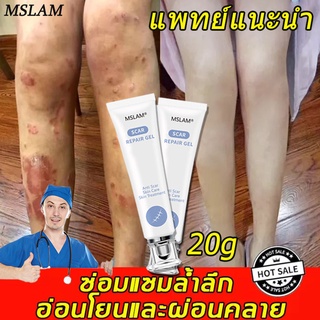 ครีมลบแผลเป็น ครีมลดรอยแผลเป็น ลดและซ่อมแซมแผลผ่าตัด ซ่อมแซมรอยแผลต่างๆ ครีมรักษาแผลเป็น ครีมลบรอยแผลเป็น ครีมทาแผลเป็น