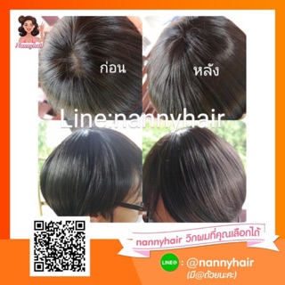 แฮร์พิชปิดผมบาง ปิดผมบาง ผมบาง เสริมผม ปิดผมขาว(พร้อมส่ง)