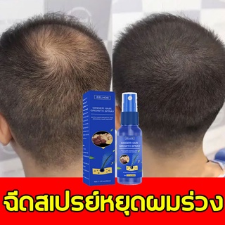 สินค้าที่ช่วยรักษาผมร่วงและศีรษะล้านEELHOEสเปรย์ปลูกผม ขิงเอสเซ้นส์บำรุงรากผมให้คงที่ ป้องกันผมร่วง ผมยาว เพิ่มผมหนาขึ้น