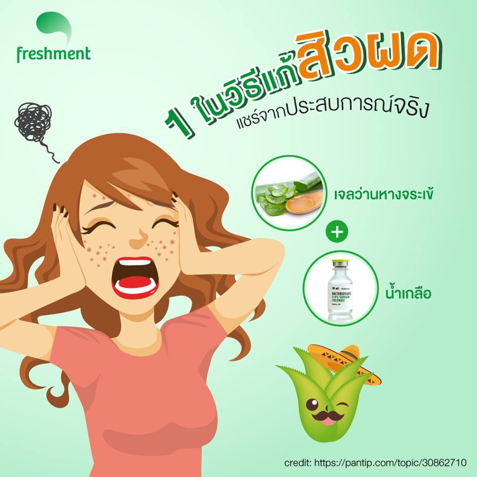 Freshment Soothing And Moisture Aloe Gel 300ml. อโลเวร่า เจลว่านหาง ...