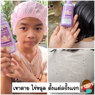แชมพูเหา 2ขวด+หวีสางสแตนเลส1ด้าม สูตรสมุนไพร อ่อนโยน แชมพูเหาเด็ก 1ขวบใช้ได้
