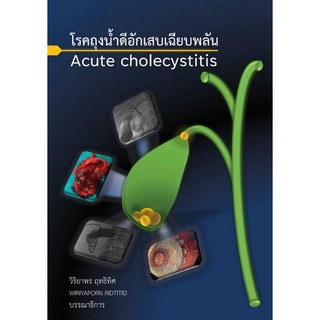 c111 โรคถุงน้ำดีอักเสบเฉียบพลัน (ACUTE CHOLECYSTITIS)9786165885508