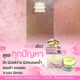 ครีมหน้าเด็กลดสิว(Aura youngest cream)