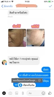 Fall in love Hensica White Mask ครีมมาส์กหน้า ลดฝ้า กระ จุดด่างดำ กู้ผิวหมองคล้ำ ลดรอยสิว หน้ากระจ่างใส สูตรเข้มข้น