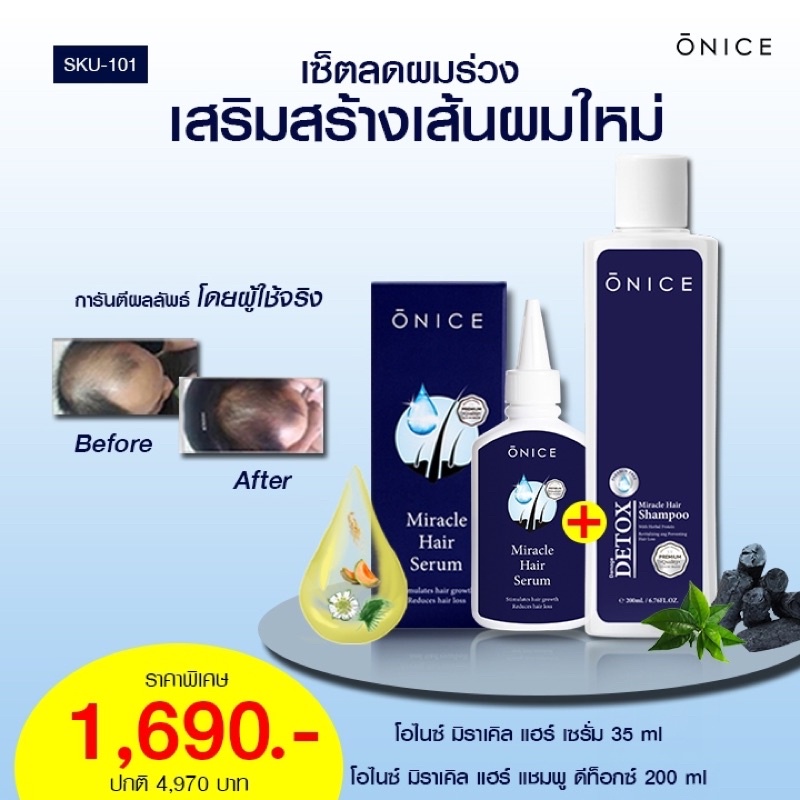 เซรั่มปลูกผม ONICE 35 ml. แถมฟรี❗แชมพูดีท็อกซ์ บำรุงหนังศีรษะ ปลูกผม ลดผมร่วง ผมบาง