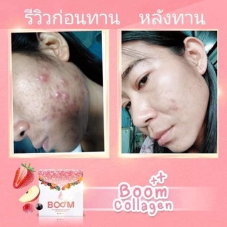 boom collagen คอลลาเจน บำรุงผิว บำรุงเล็บ ลดสิว