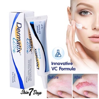 Dermatix Ultra Gel เดอร์มาติกซ์ อัลตร้า เจล ครีมลดรอยแผลเป็น ครีมรักษาแผลเป็น ครีมลบแผลเป็น เจลลดรอยแผลเป็น แผลเป็น