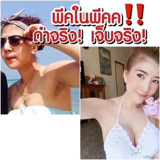 ☞♛❡ครีมทารักแร้ขาว(Winkplus)