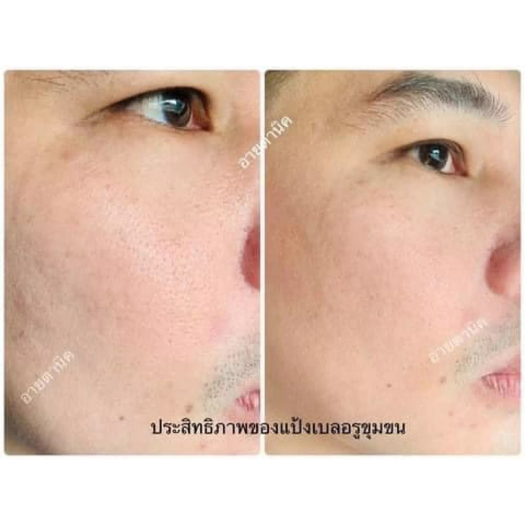 Eitanic بودرة سائبة شفافة Miracle Matte لإخفاء المسام — صورة 4