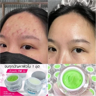 ครีมบริ้งไวท์ ครีมแก้ฝ้า รักษาสิว บำรุงหน้าใส (ส่งฟรีมีปลายทาง🎁 มีของแถม)