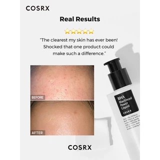 COSRX BHA Blackhead Power Liquid 100ml เอสเซนส์ผลัดเซลล์ผิว ทำความสะอาดรูขุมขนที่อุดตัน ขจัดสิวและสิวหัวดำ ผิวกระจ่างใส