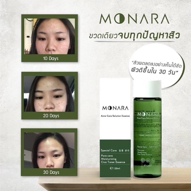 ลดแรง‼️MONARA น้ำตบลดสิว 3in1 ตบ เช็ด มาร์ก