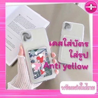 case เคสใส่บัตร ใส่รูป รุ่นคลุมกล้องหลัง ป้องกันกล้องหลัง รุ่นขายดี