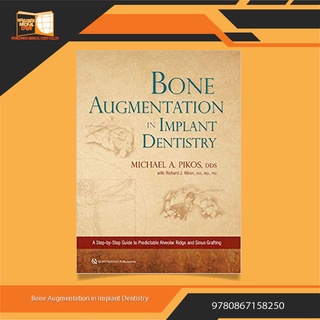 Bone Augmentation in Implant Dentistry