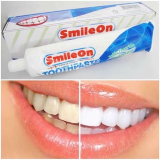 ยาสีฟันสไมล์ออน(Smile On) ราคาถูก ราคาส่ง ส่งฟรี! แท้𝟏𝟎𝟎%