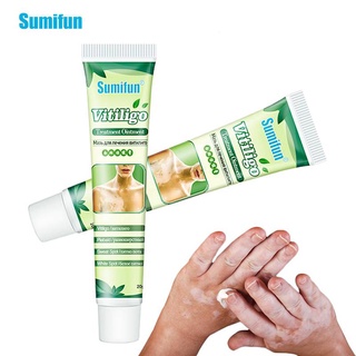 Sumifun ครีมบํารุงรักษาโรค รักษาจุดด่างดํา Leukoplakia ครีมซ่อมแซมโรค Vitiligo เมลานิน บาล์มดูแลผิว 20 กรัม