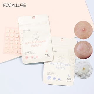 Focallure แผ่นสิว แผ่นแปะสิว สิว รักษาสิว บำรุงผิว ซ่อมแซม กันน้ำ ทำความสะอาดอย่างเชี่ยวชาญ