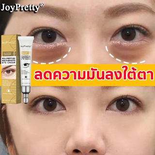 JoyPretty ครีมทาใต้ตา 20g ชุ่มชื้นและชื้นเพื่อลดความจางหายของตาดําถุงตาเม็ดไขมันลายละเอียด ( ครีมลดขอบตาดำ ขอบตาดำ ครีมทาใต้ตาดำ ครีมใต้ตา ครีมลดถุงใต้ตา ครีมทาขอบตาดำ อายครีม ครีมทาถุงใต้ตา ครีมลดใต้ตาดำ อายครีมบำรุงตา ครีมบำรุงรอบดวงตา）eye cream