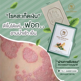 เคโบ๊ะสบู่สมุนไพรแท้ แก้คัน รักษาโรคผิวหนังจากเชื้อรา 100g (ชุด6ก้อน แถมถุงตีฟอง)