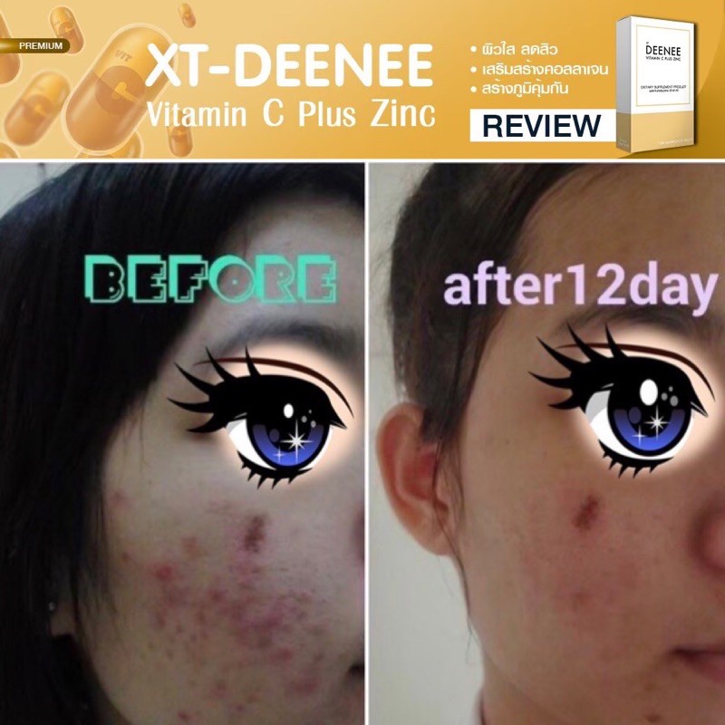 วิตามินซี ลดสิว ผิวใส แบ่งขาย ส่งฟรี  เห็นผลไวชุด 30 วัน VITAMIN C DEENEE เกรดส่งนอก 30 เม็ด ราคา ถูกที่สุด ดีลบีเคเค แกลเลอรีภาพที่ 6