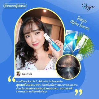 Regro Alpha Serum 45 ml. ซีรั่มสูตรเข้มข้นลดผมร่วง ผมบาง จากฮอร์โมน กรรมพันธุ์ พร้อมกระตุ้นการสร้างเส้นผมใหม่ได้รวดเร็ว