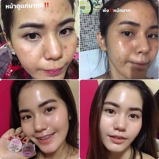 ครีม Lamona ของแท้💯%