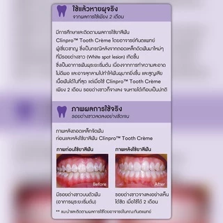 ยาสีฟัน 3M Clinpro Tooth Creme รสสเปียร์มิ้นต์ - Spearmint Exp. 2028