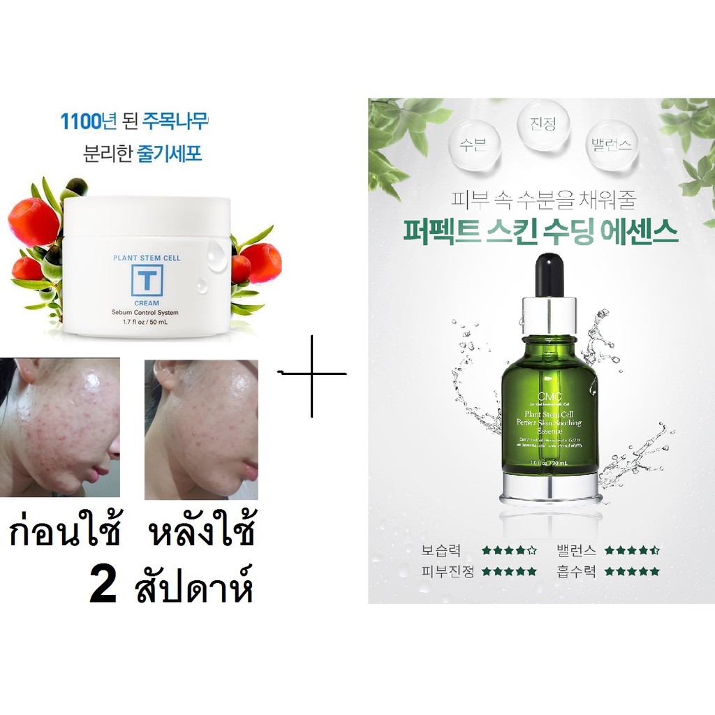 เซตรักษาสิว​ SN PLANT STEM CELL CREAM +Plant Stem Cell Perfect Skin Soothing Essence