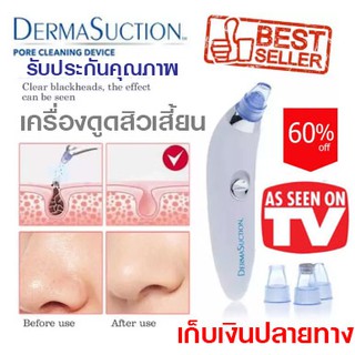 Derma Suction Pore Cleansing Device เครื่องดูดสิวไฟฟ้า📍