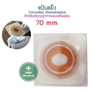 Convatec แป้นแข็ง สำหรับ 1ชิ้น สำหรับติดถุงอุจจาระแบบเต็มแผ่น. #แป้นติดหน้าท้อง เบอร์ 45 /57 /70