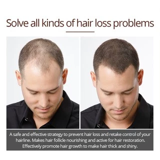 Hair Growth ยาปลูกผม น้ำยาปลูกผม บำรุงผม ปลูกผม เซรั่มปลูกผม ป้องกันผมร่วง เพื่อผมหนา ผมเงา ผมดกกำ บำรุงรากผม