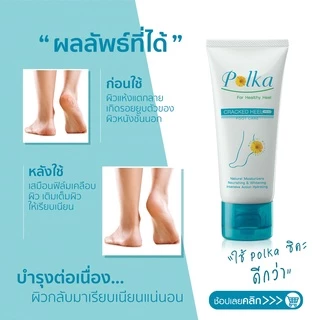 Polka Cracked Heel Cream 60 g. ครีมทาส้นเท้าแตก