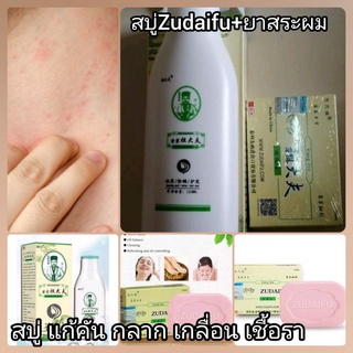 Zudaifu สบู่ ยาสระผม สำหรับช่วยเรื่องผิวหนัง สะเก็ดเงิน คัน เกลื้อนเชื้อรา สูตรต้นตำหรับยาจีน เหมาะกับอากศร้อนบ้านเรา