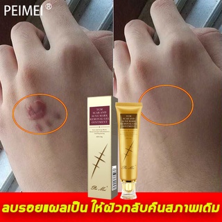 PEIMEI ครีมลดรอยแผลเป็น 30g ยับยั้งการเกิดแผลเป็นใหม่ ยาลบลอยแผลเป็น ครีมลดแผลเป็น แผลเป็นหลายประเภท ครีมลดแผลเป็น