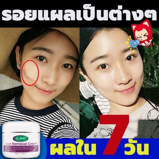 ELAIMEรอยสิวแผลเป็น（ครีมลดแผลเป็น，เจลลดรอยแผลเป็น，ครีมลดรอยสิว，ยาลบลอยแผลเป็น， ครีมทาแผลเป็น，ครีมลดรอยแผลเป็น）