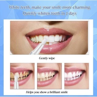 ฟอกฟันขาว ฟันขาว น้ำยาฟอกฟันขาว ที่ฟอกฟันขาว ยาฟอกฟันขาว น้ำยาขัดฟันขาวTeeth Whitening Pen ปากกาฟอกฟันขาว เจลฟอกฟันขาว