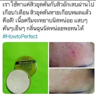 Nixoderm ครีมรักษาสิว สิว สิวอักเสบ สิวอุดตัน สิวผด ผื่น กลากเกลื้อน อาการคัน เชื้อรา บรรเทาอาการคันตามผิวหนัง ผลิต07/21