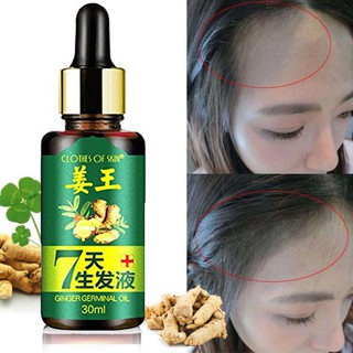 เซรั่มปลูกผม กันผมร่วง ผมบาง Hair Growth Ginger Oil Natural Plant Essence Faster Grow