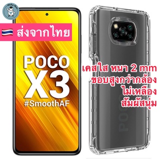 เคส Poco X3 Pro / X3 NFC เคสใส ขอบกันกล้อง กันกระแทก