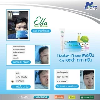 Exp.5/2027 บอกลารอยแผลเป็น (10 กรัม x 2 หลอด) Ella Scar Cream เอลล่าสกา ครีม