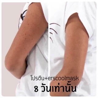 Ers ตัวเร่งลดรอยดำติดสปีด