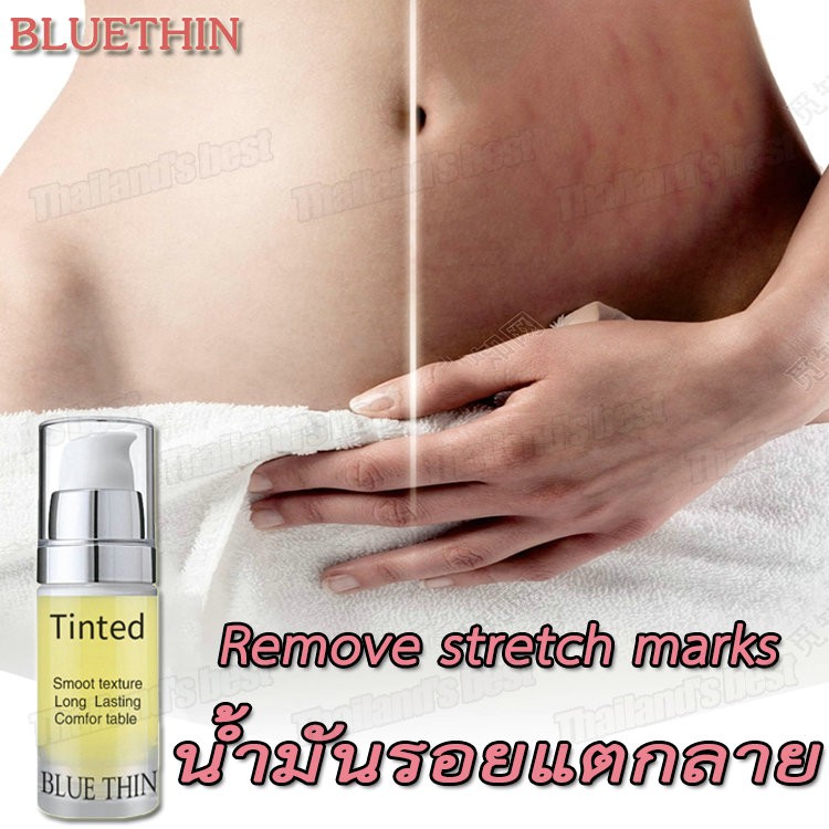 ลบเครื่องหมายยืด กันท้องลาย ครีมทาท้อง พาสเจล ลดผิวแตกลาย ครีมแก้ท้องลาย ครีมบำรุงผิว Stretch mark o