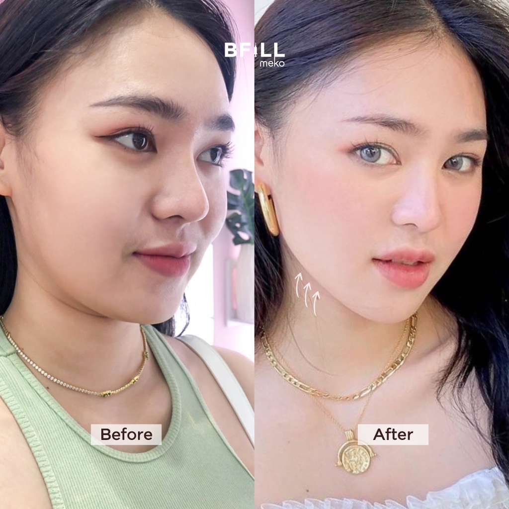 Premium Hifu By Doctor พรีเมียม ไฮฟู่ ทำโดยคุณหมอ