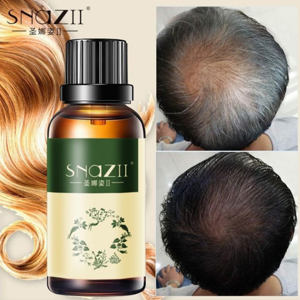 โค ด Cblife30 ลด 30 Hair Growth Essence Advanced Thinning Hair