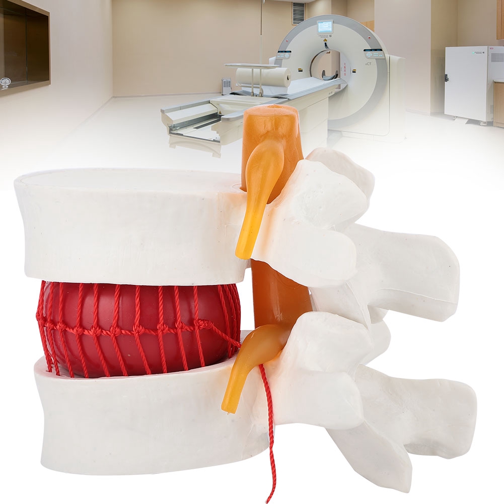 Human Model Herniation Lumbar Medical Disc Of Spine Vertebral