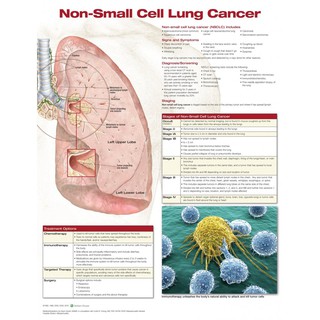 ชาร์ตมะเร็งปอด เซลล์ขนาดเล็ก โดย Wolters Kluwer